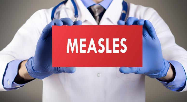 measles